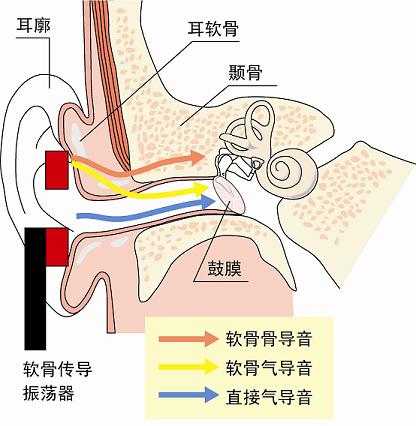 軟骨傳導的機理