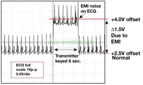 1.5 英尺以外的發射器（f = 470 MHz, P= 0.5W）開啟和關閉時ECG 診斷設備的心臟檢查結果