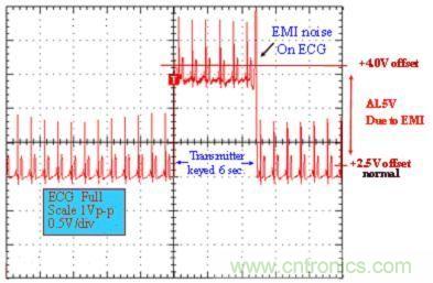 圖 1：醫用 ECG 測量設備的性能